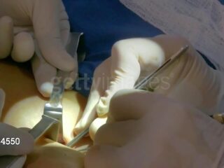 Aj lee from wwe gets her third breast implant: mugt x rated clip 8e